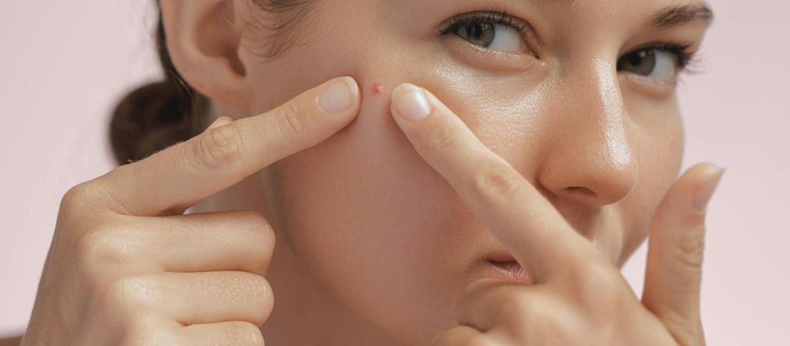 Furoncle sur le visage : causes, faut-il le percer ? Furoncle sur le visage : causes, faut-il le percer ?